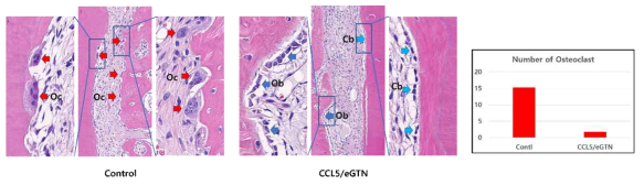 CCL5/eGTN의 처치군(실험군)에서 osteoclast의 출현이 현격히 감소된 것을 확인하였음. 이로 인해 osteogenic potential이 증가되고 cementum regeneration이 향상되었다고 판단할 수 있으며 이를 CCL5에의한 치주 조직 재생 향상의 기전으로 제시할 수 있었음