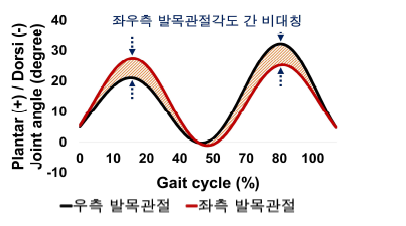 평지보행시 좌우측 발목관절 차이