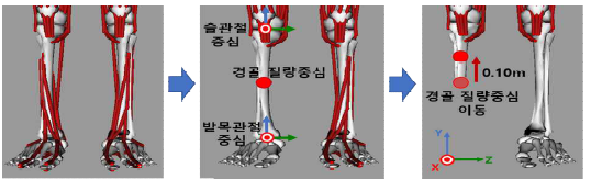 하퇴절단 모델링