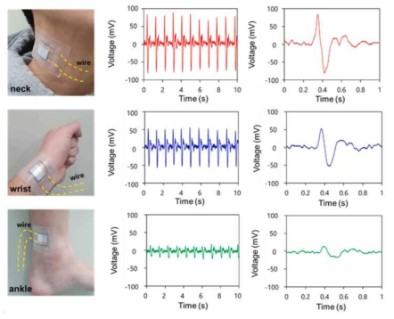 개발된 고효율·고민감도 유연 압전 디바이스의 인체 센서 적용 결과