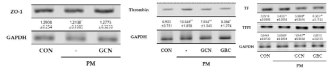 RT-PCR을 통한 미세먼지로 자극된 쥐 대동맥에서 ZO-1발현량 변화 및 GCN의 혈액응고인자 Thrombin의 발현량 감소 정도 분석 및 TF, TFPI 그리고 GAPDH 발현량 변화. 그룹 간 통계적으로 유의미한 차이는 one-way ANOVA/Dunnett’s t-test를 사용하여 분석함, (*P<0.05, ***P<0.001 vs. Control and #P<0.05 and ##P < 0.01 vs. negative control)