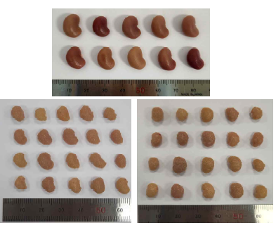 Control과 CKD kidney