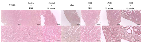 Mice were sacrificed, and their hearts were collected for H&E staining