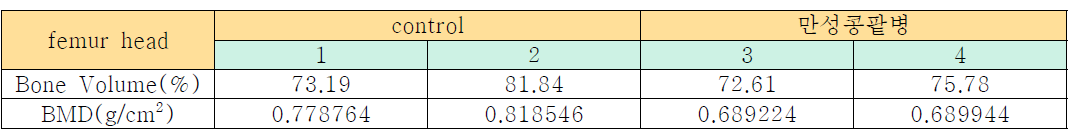 control 과 만성콩팥병 femur head의 bone volume과 BMD 측정