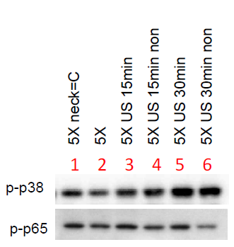 노화 및 US에 의한 동물 모델의 p38, p65 인산화 확인
