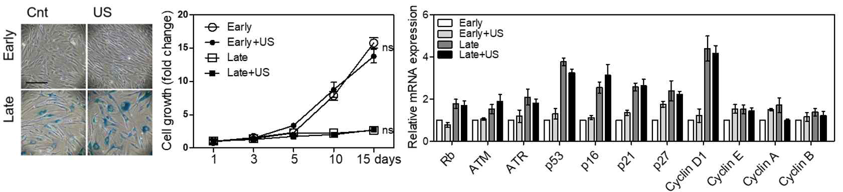 초음파에 의한 노화세포 세포 활성화 주기 및 세포 주기 관련 mRNA 변화