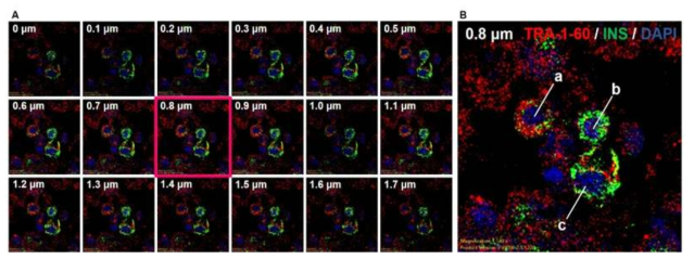 TRA-1-60과 인슐린을 동시에 발현하는 세포의 관찰. A. D3 오가노이드에서 TRA-1-60 (Red)과 인슐린 (Green)을 표지 후 0.1㎛ 두께 조절을 통한 세포의 3차원 관찰 모습. B. A의 확대 사진 a:분화가 시작된 세포, b:분화가 이루어진 세포, c: 분화중인 세포