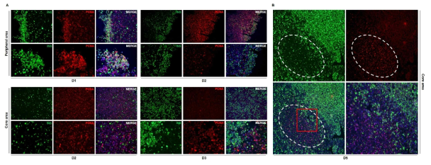 오가노이드의 형성과정에 따른 인슐린과 PCNA의 발현의 분포 관찰. A. 오가노이드 형성과정 (D1, D2, D3)에서 peripheral, core part의 인슐린 및 PCNA 발현 추이. B. D5 오가노이드에서 인슐린 발현 세포 area과 PCNA 발현 세포 area의 경계 부위