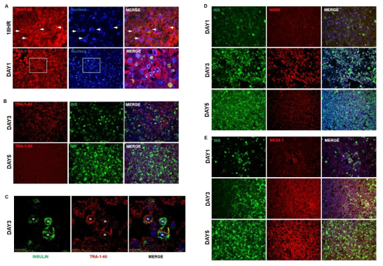 오가노이드 형성 과정에서 중간엽 줄기세포에서 인슐린 발현 세포로 분화 과정. A. 오가노이드 형성 과정(18hr, D1, D3, D5)에서 중간엽 줄기세포의 표지자 TRA-1-60의 발현 양상. C. D3 오가노이드 내 TRA-1-60과 인슐린의 동시발현 세포 관찰. D, E. 오가노이드 D1, 3, 5에서 NGN3 및 NKX6.1과 인슐린의 동시 발현