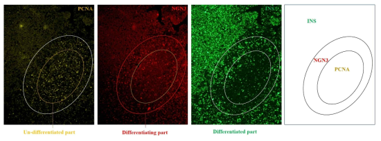 D5 오가노이드 내 PCNA, NGN3, 인슐린의 발현 양상. D5 오가노이드에서 PCNA, NGN3, 인슐린 발현 세포의 분포