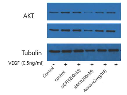 si-RNA를 이용하여 확인한 Target A 후보 물질과 Bevacizumab 군 AKT 발현의 차이