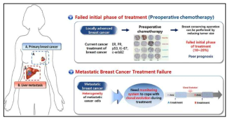 유방암 환자의 초기 치료 실패 및 전이된 경우 유전적 변이에 대한 모니터링이 필요함