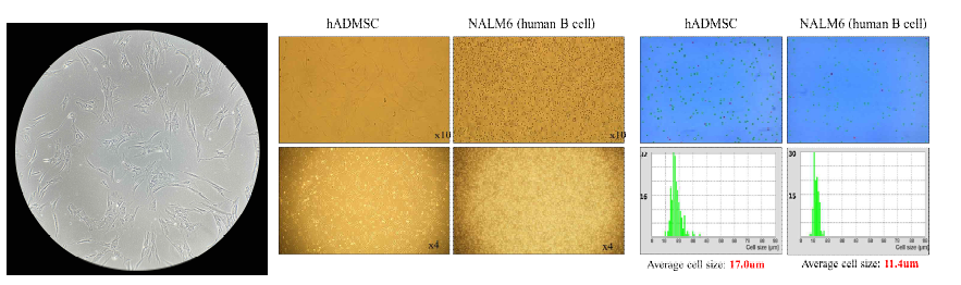 hADMSC의 배양과 NALM-6 (human B cell leukemia) cell line의 세포 크기 측정 결과