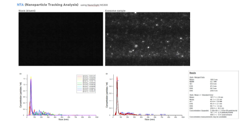 Nanoparticle tracking analysis 장비를 이용한 모유 유래 방수 엑소좀의 입자 크기 및 농도 측정