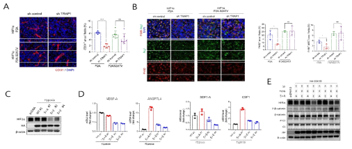 GSK3β 인산화의 HIF1 하위신호 변성. (A) HIF1α돌연변이 발현암세포의 orthotopic xenograft 조직에서 혈관 분석. (B) HIF1α 돌연변이에 의한 대식세포 분포변화. (C) GSK3β돌연변이 세포주에서 HIF1α 조절. (D) GSK3β돌연변이에 따른 cytokine발현의 변화. (E) 인산화 위치에 따른 HIF1α의 안정성 조절