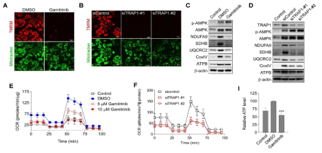 TRAP1과 미토콘드리아 활성. (A) Gamitrinib 처리시 막전위. (B) TRAP1 siRNA 처리시 막전위 (C,D) 전자전달계 구성성분변화. (E,F) 산소소모량 분석. (I) 세포내의 ATP농도분석