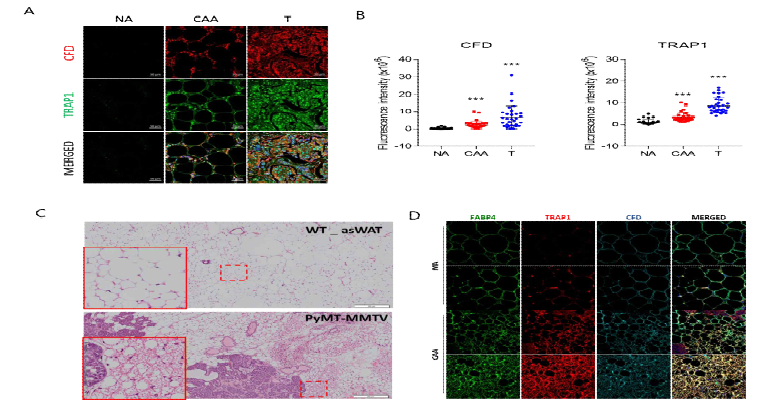 유방암 환자 검체 분석결과와 종양미세환경에서 발암촉진하는 TRAP1 기능. (A) 유방암 환자검체의 histology. (B) 검체 분석 결과 요약. (C) control 쥐와 PyMT-MMTV 유방암 실험쥐의 비교. (D) 실험쥐 모델에서 TRAP1 과 CFD 발현 비교 (CAA, 암연관 지방세포; NA, 정상지방세포). (E) Wild type쥐와 TRAP1의 지방세포 KO 실험쥐에서의 종양성장 (orthotopic)과 Cisplatin 항암제 처리 후 항암활성 비교. (F) TRAP1 억제제 처리후 분석