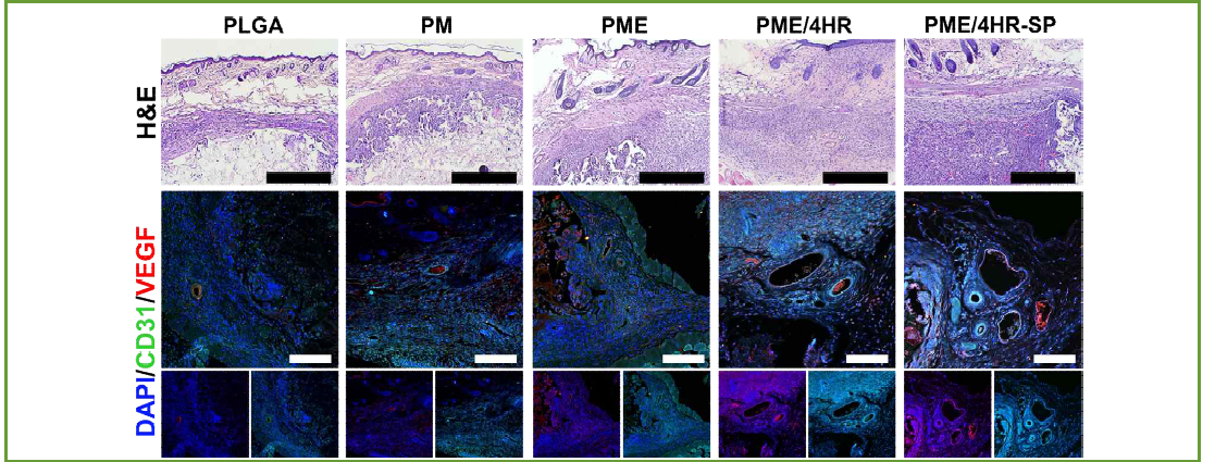 고기능성 지지체의 쥐 피하 이식 후 2주 H&E 염색 및 혈관형성 마커 형광염색