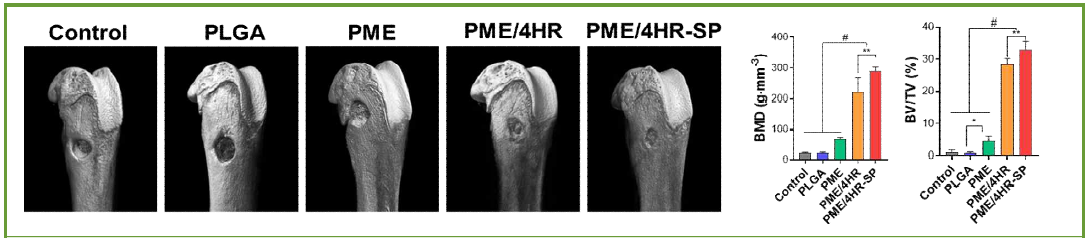 랫드 골다공증 골 결손 모델에 이식한 고기능성 지지체의 Micro-CT 이미지 및 정량분석