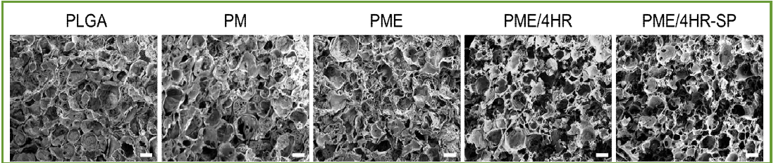 주사전자현미경을 통한 지지체의 형태와 다공도 평가 (PLGA, PM, PME, PME/4HR, PME/4HR-SP)