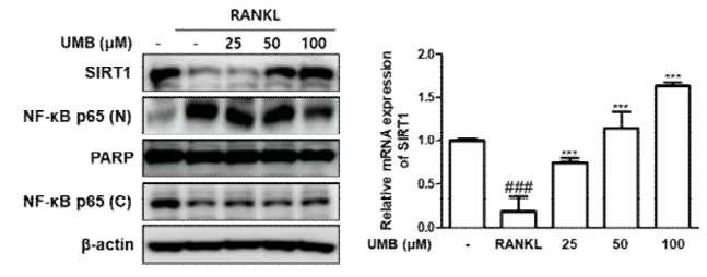 파골세포에서 SIRT1 관련 발현 확인 (###p < 0.001 vs. 비처리군, ***p < 0.001 vs. RANKL)