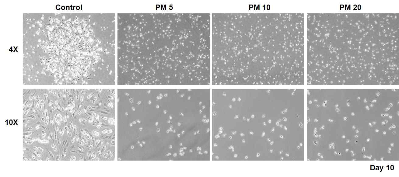 PM2.5에 의한 제대혈 혈관 내피 전구세포의 분화능 감소