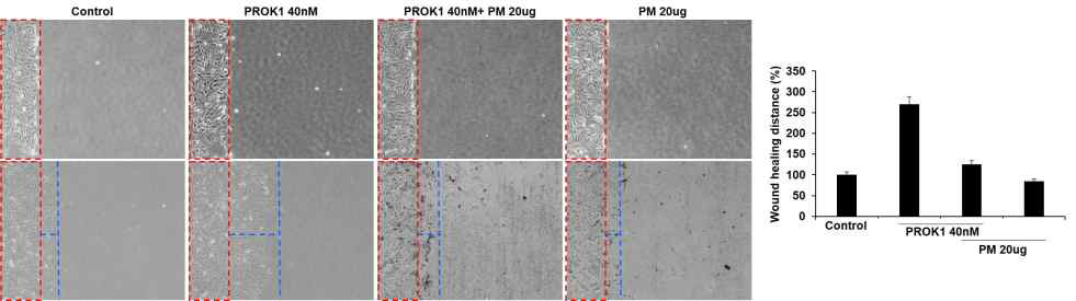 PM2.5에 의한 Trophoblast wound healing능 감소