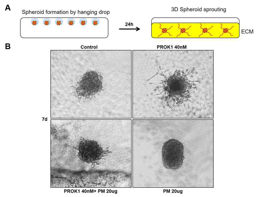 PM2.5에 의한 Trophoblast의 3D sprouting 감소