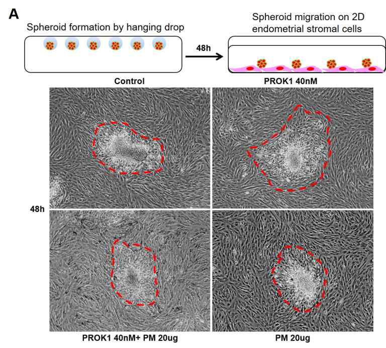 PM2.5에 의한 Trophoblast의 2D migration 감소