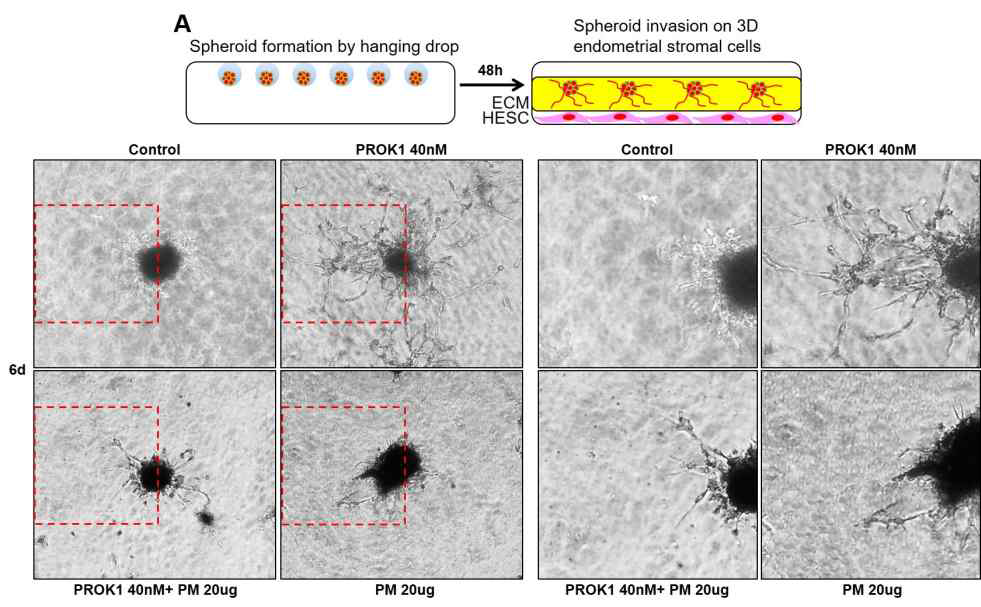 PM2.5에 의한 Trophoblast의 3D structure formation 감소