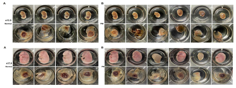 PM2.5에 의한 embryo 및 태반의 발생 저하