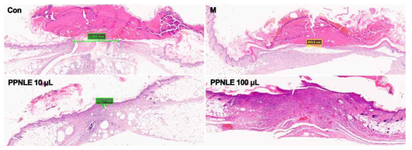 Effect of PPNLE on re-epithelialization on the skin wound area. The tissues harvested from the skin wound area of rats (each group, n=5) treated with or without PPNLE (100 mg/ml) were used in hematoxylin eosin staining for re-epithelialization. Wound area represented as scale bar. The values are shown as means ± SD. *p<0.05 and **p<0.01 compared to the control