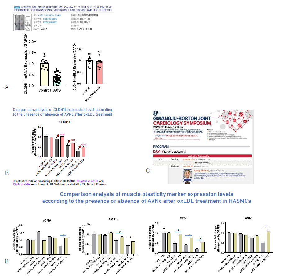 Differential CLDN11 mRNA Expression in ACS and MCA Occlusion Patients. Quantitative RT-PCR analyses of peripheral blood samples revealed a statistically significant reduction in CLDN11 mRNA levels in patients with acute coronary syndrome patient (ACS, n=23) compared to a control group (n=14) (Student's t-test, p<0.0001). In contrast, changes in CLDN11 mRNA expression in stroke patients with middle cerebral artery (MCA) occlusion (n=14) were not statistically significant when compared to controls (n=10), highlighting a potential divergence in molecular response between ACS and MCA occlusion events