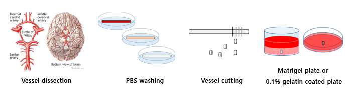 뇌혈관 배양 시스템 과정 모식도