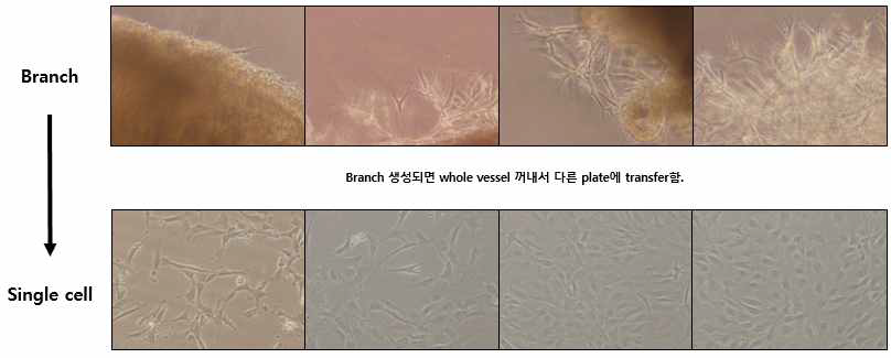 Matrigel 기반에서 배양한 대뇌동맥혈관에서의 single cell 분리