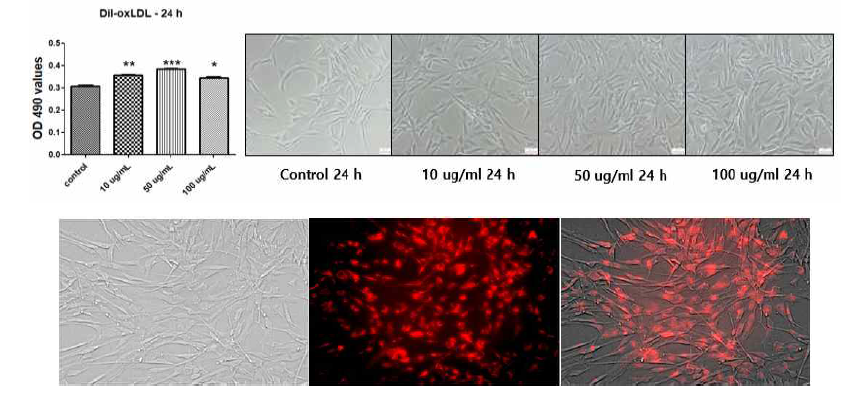 DiI-oxLDL을 50 ug/ml로 24시간 동안 세포에 처리하였을 때의 cell proliferation effects 및 fluorescent microscope image