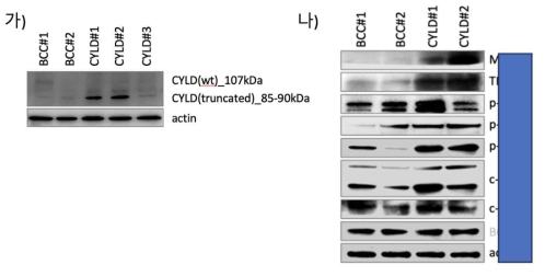 Brooke-Spiegler 환자에서의 단잭질 정량 분석. 가) truncated form의 CYLD가 축적되어 있는 western blot 결과. 나) Brooke-Spiegler환자에서 활성화되어 있는 생물학적 경로에서의 western blot