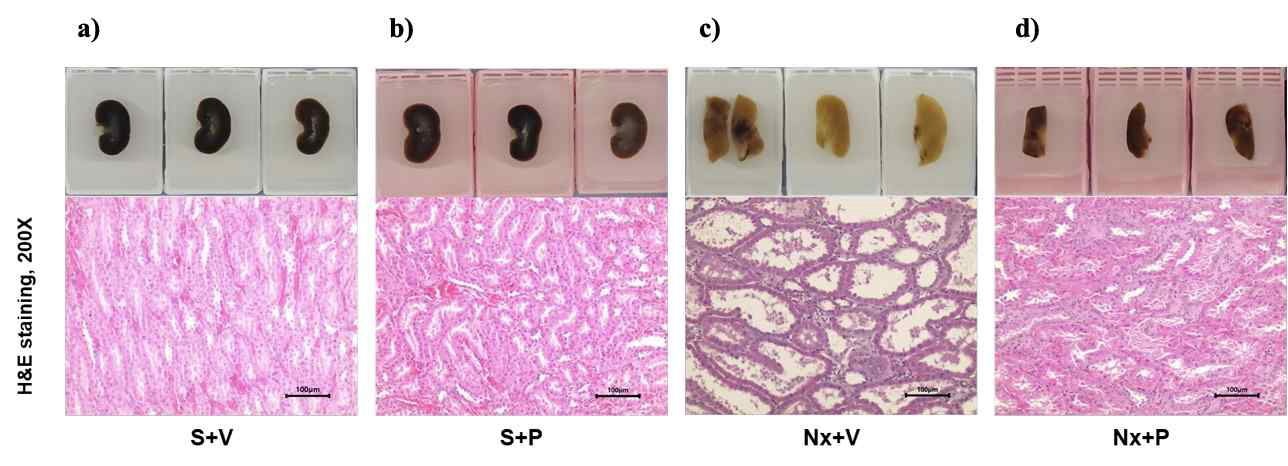각 그룹 신장의 조직병리학적 검사 (H&E staining)