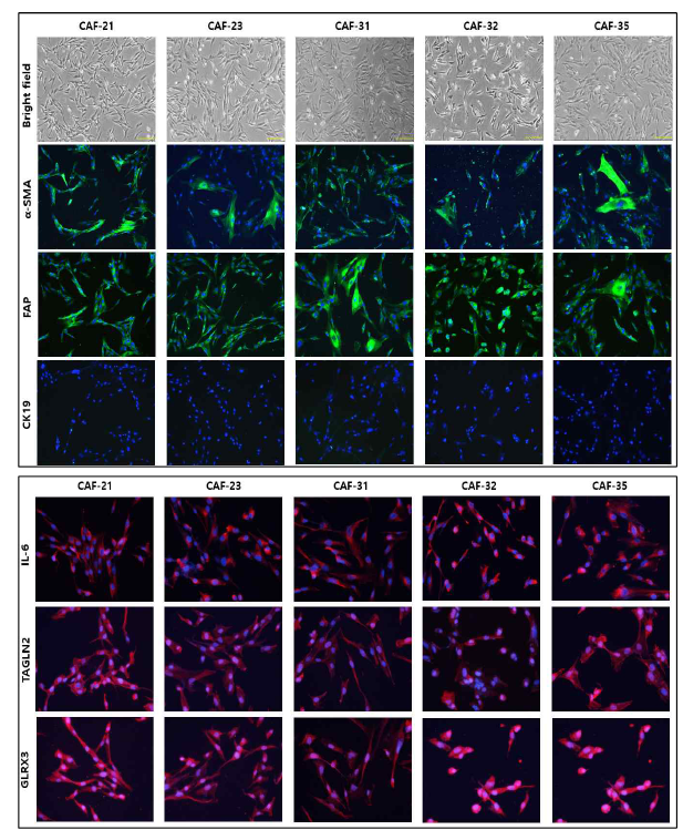 환자 유래 CAF에서 fibroblast 확인을 위한 marker 와 발굴한 후보 마커의 발현 확인