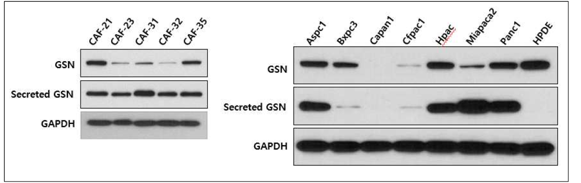 TME 마커 GSN 의 췌장암 환자 유래 CAF 및 CAF 배양액에서의 발현 증가를 확인
