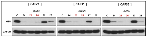 shRNA를 이용한 GSN stable knockdown CAF 구축
