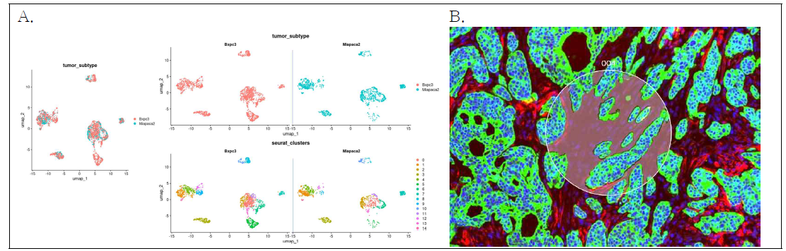 EMT type 에 따른 CAF 마커 발현 차이 분석. A. scRNA 분석, B. spatial genomics 분석