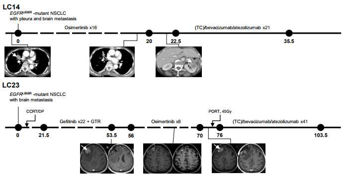 The timeline indicates the time points of tissue acquisition, with white arrows on the images indicating the sites from which tissues were obtained. The numbers on the timeline represent the number of months since the diagnosis of metastatic NSCLC. LC14 and LC23 presented