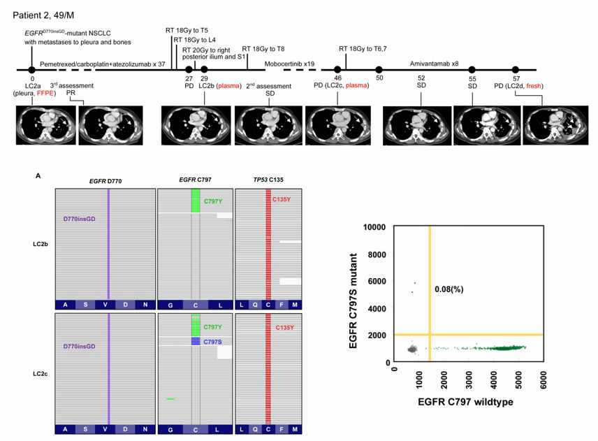 Acquired EGFR mutations confer resistance to EGFR Ex20ins-selective TKIs