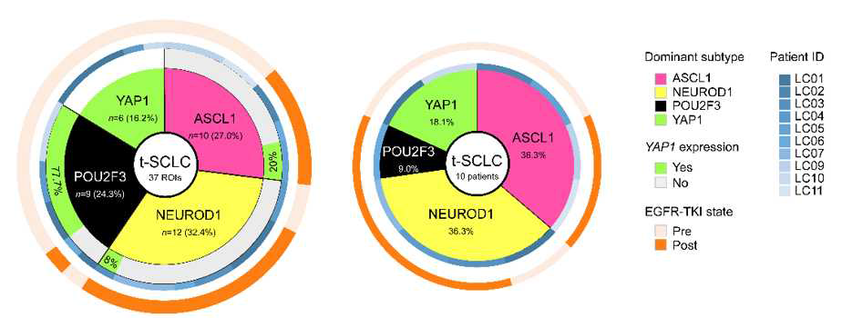 Characteristics of t-SCLC Doughnut chart showing the proportion of dominant subtypes in t-SCLC per ROIs (left) or patients (right)