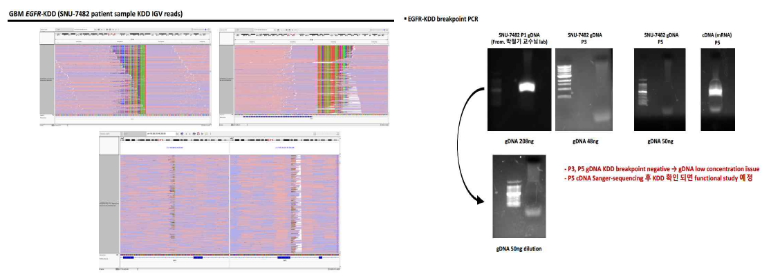 igv and PCR product