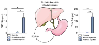 알코올 섭취에 따른 담즙산과 FGF-19의 증가