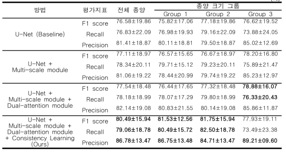 폐암 분할 결과