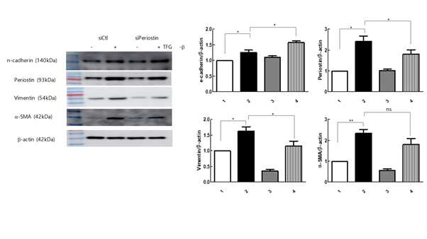 BEA2 세포에서 페리오스틴 약독화 TGF 베타1 유도 EMT의 녹다운 실험 결과