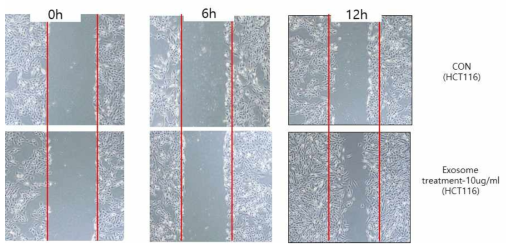 exosome 처리를 통한 migration 변화 검증. HCT116 세포주에 exosome을 처리함으로서 세포의 migration이 증가함을 확인함으로서 관련 기전의 연구의 필요성이 존재함을 시사함